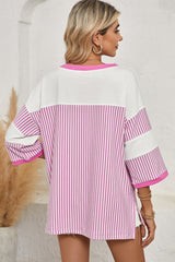 Black & White Striped Patchwork Oversized Tee