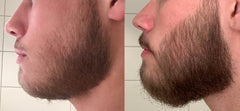 Beard Growth Oil